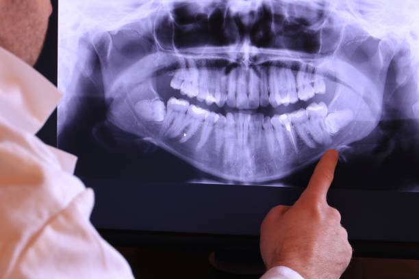 Best Emergency Tooth Extraction in Alexandria, IN
